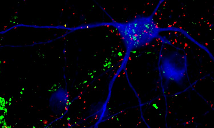 Therapeutics