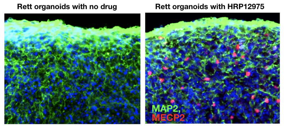 Organoids figure 2